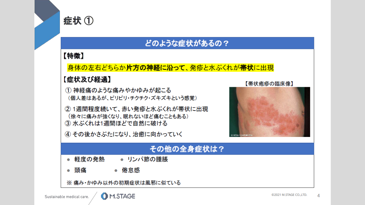 【スライド】帯状疱疹について-4